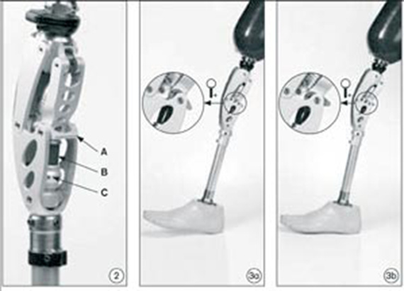 Prosthesis